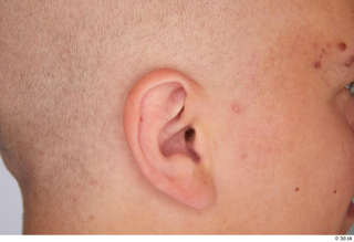 Jerome ear 0002.jpg